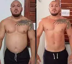 Antes e Depois 4